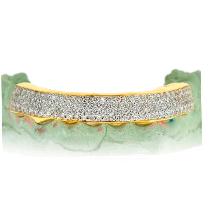 8 Top and 8 Bottom Moissanite Teeth Grillz in 925 Sterling Silver for Men's fashion