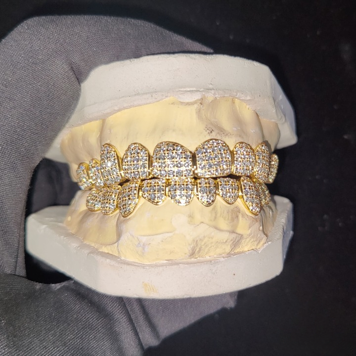 Iced Out Moissanite Diamond Grillz - Silver and Gold Teeth Grillz, 8 top & 8 bottom Hip Hop Rapper Grillz